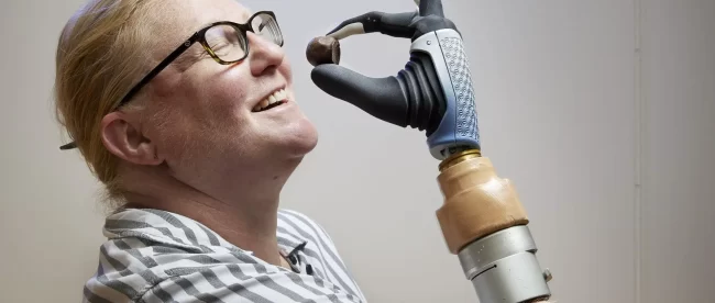 BIONIC BREAKTHROUGH: REVOLUTIONARY PROSTHETIC TECHNOLOGY RELIEVES PAIN AND ENHANCES FUNCTIONALITY FOR AMPUTEES