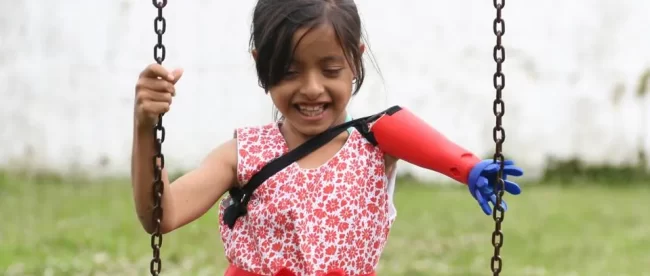 AUTOFABRICANTES: TRANSFORMING LIVES THROUGH PERSONALIZED PROSTHETICS AND INCLUSIVE HEALTHCARE